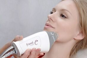 جوهر إجراء تجديد شباب بشرة الوجه الجزئي